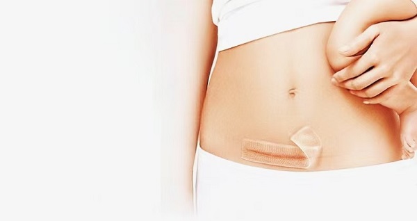 చిక్కటి సిలికాన్ జెల్ స్కార్ షీట్‌లు ఎందుకు బాగా ప్రాచుర్యం పొందాయి?